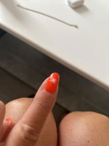 Anonyme review photo
