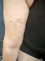 Lyndsay review photo