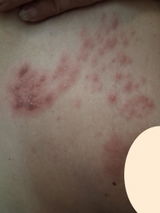 Anonymous review photo