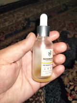 Anonymous review photo