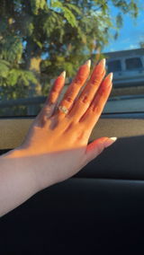 Anonymous review photo