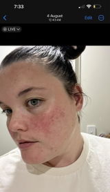 Shanice Hoad review photo