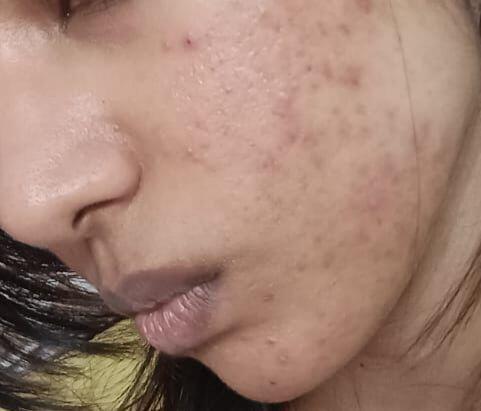 Vaishnavi K Nair review photo