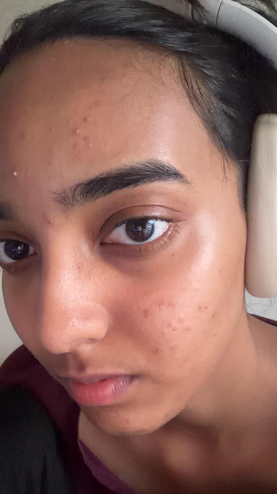 Apati Ruchitha review photo