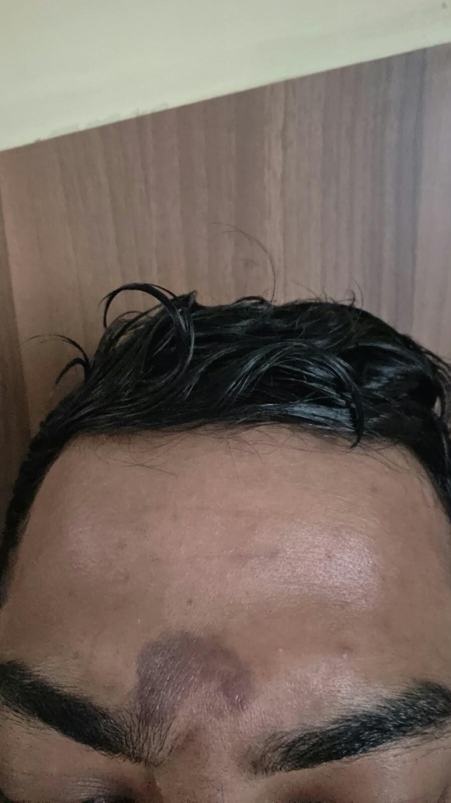 Review picture