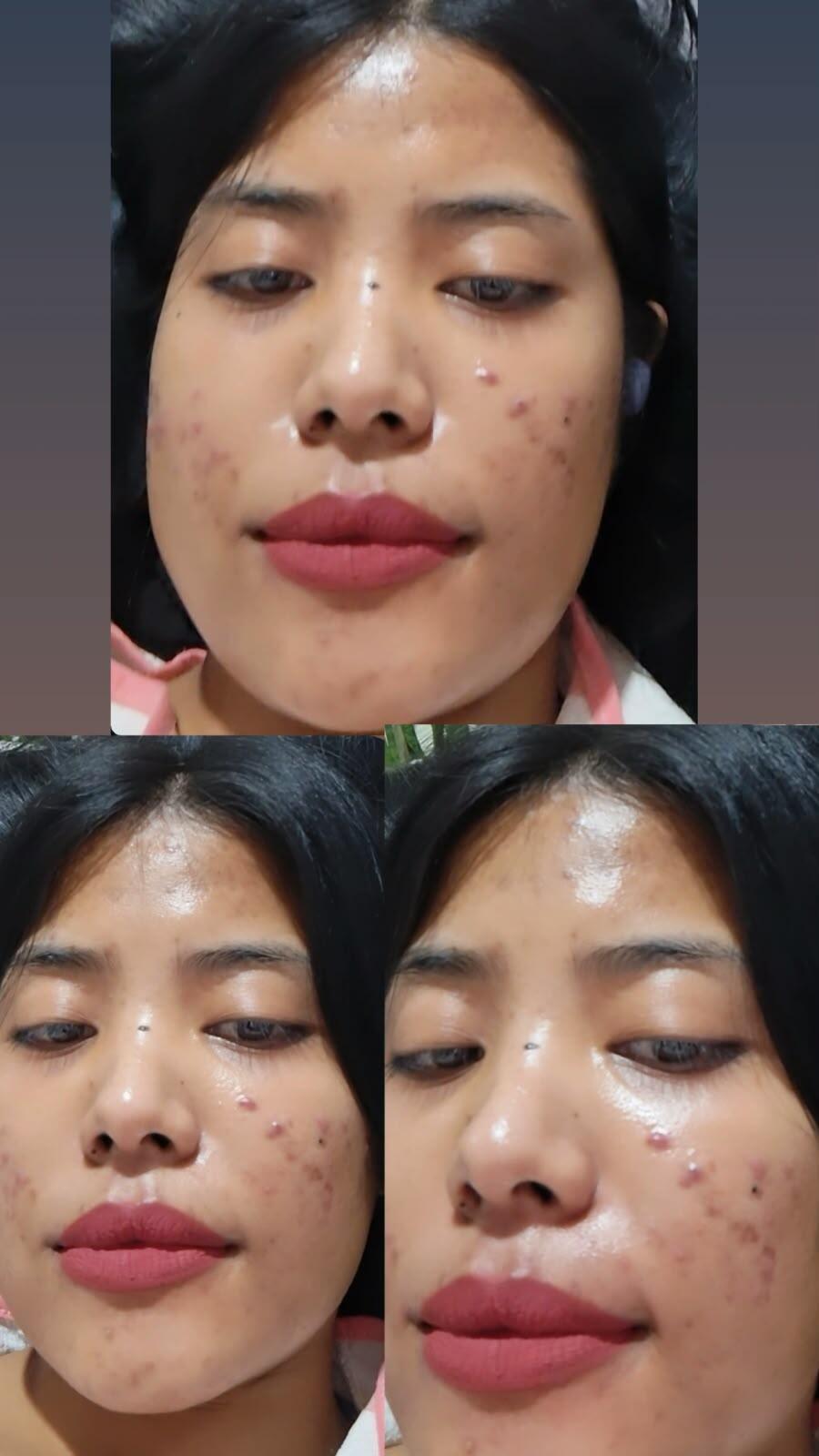 Review picture