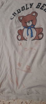Anonymous review photo