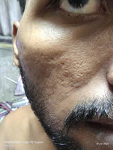 Nitin review photo