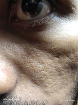 Nitin review photo
