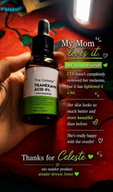 Alina Zerin review photo