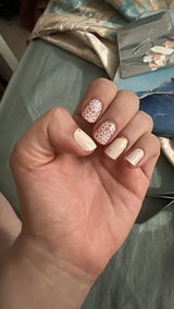 Anonyme review photo