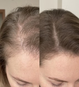 Buse Y. review photo