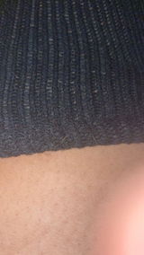 Anonymous review photo
