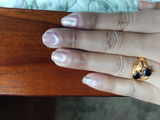 Anonymous review photo
