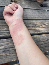 Rescue Balm
