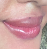 Renu R. review photo