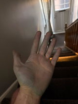 Anonymous review photo