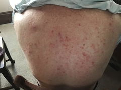 Review picture