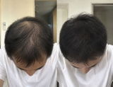 Hiroshi review photo