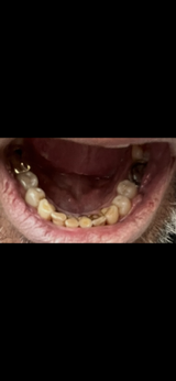 Dee review photo