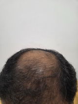 Amit Kumar review photo