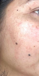 Skin Shield Boost Serum