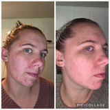 Gentle Tea Tree Face Cleanser