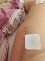 Anonimno review photo