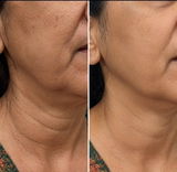 Madhu Chopra review photo