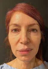 Lorena review photo