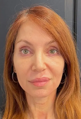 Lorena review photo