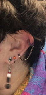 Lindsey Klein review photo