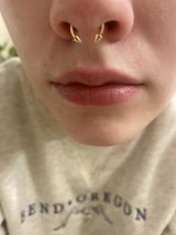 Alex Hoopes review photo