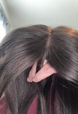 Alisson review photo
