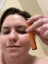 Anonymous review photo