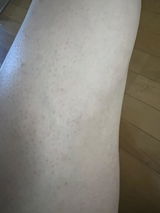 匿名 review photo