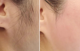 匿名 review photo