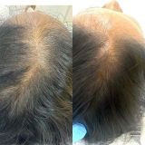 d. review photo