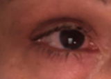 Zoeuk review photo