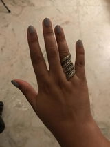 Anonymous review photo