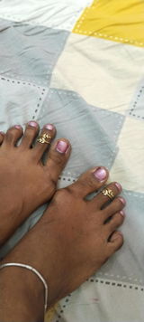 Toe ring review photo