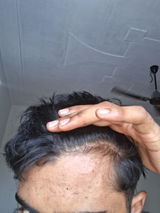 Anonymous review photo