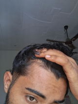 Anonymous review photo