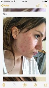 Amazon Customer review photo