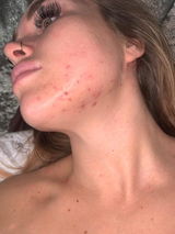 Amazon Customer review photo