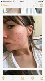 Amazon Customer review photo