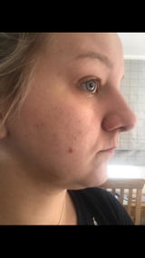 Amazon Customer review photo
