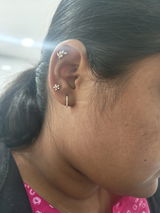 KT review photo