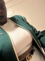 Anonymous review photo