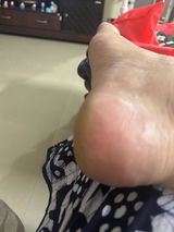 Anonymous review photo